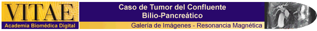 Cintillo Resonancia