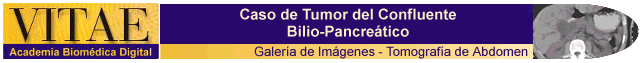 Cintillo Tomografa