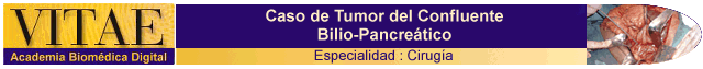 Cintillo Ciruga