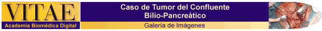Cintillo Galera