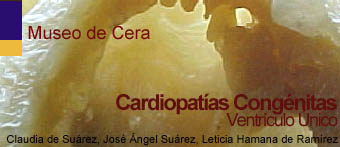 Cardiopat&iacute;as Cong&eacute;nitas