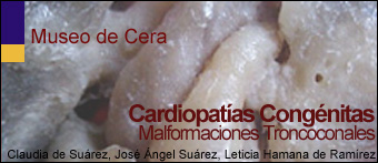 Cardiopatías Congénitas